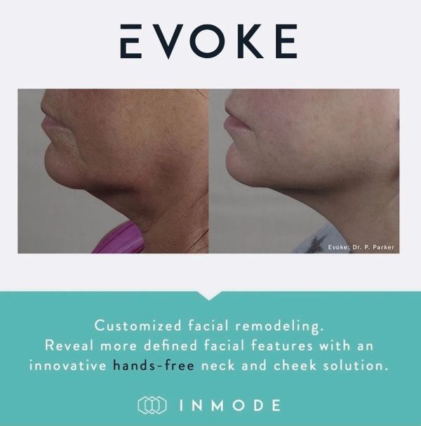 evoke evoke